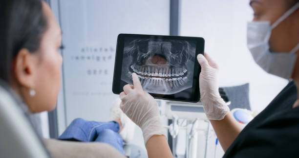 Licensed Tooth Extraction service in Fort Mill, SC - Smile Center Dentistry